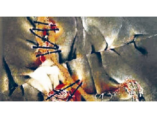 Dibujo. “Costuras y suturas” integra la muestra “Entre-Telas”.