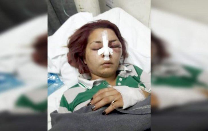 Priscila Barreto luego del ataque