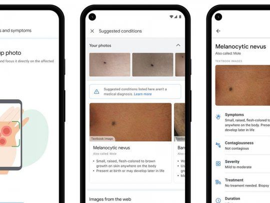 La nueva app de Google, al servicio de la salud de la piel, emplea inteligencia artificial.