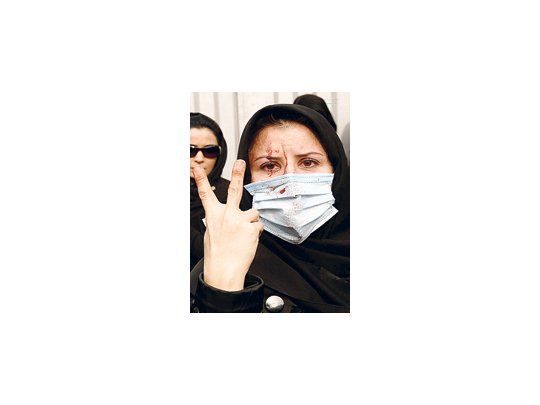 Una mujer iraní herida el domingo muestra la señal de la victoria. Durante los incidentes de ese día, los manifestantes les hicieron frente a la Policía y a las milicias Basij, en un desafío inédito.