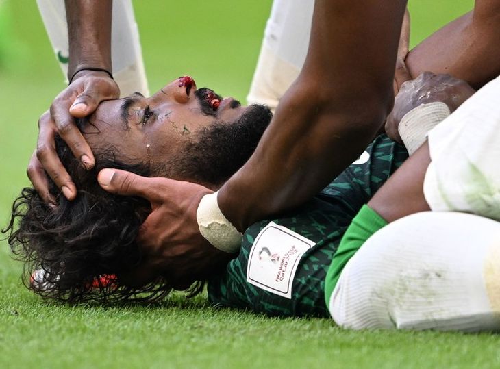 Yasir Al Shahrani shocked football at the start of the 2022 Qatar World Cup. Yasir Al Shahrani shocked football at the start of the 2022 Qatar World Cup.