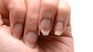 It is a vitamin that is not only essential for nails, but for the health of the body. It is a vitamin that is not only essential for nails, but for the health of the body.