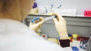 Actualizaron el criterio clínico y epidemiológico para confirmar casos de Covid-19