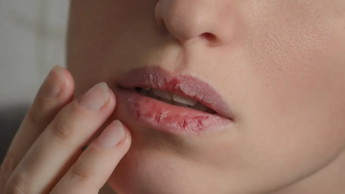 The ultimate trick to avoid dry lips this winter