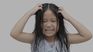 The lice are generally infected in schools.