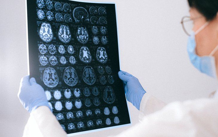 piden prestar atencion a sintomas neurologicos asociados al coronavirus