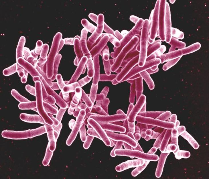 Bacteria Mycobacterium tuberculosis. Bacteria Mycobacterium tuberculosis.