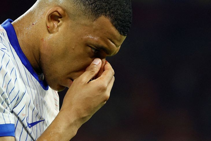Kylian Mbappé will also miss matches with the French national team. Kylian Mbappé will also miss matches with the French national team.