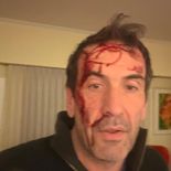 Cervi compartió esta foto tras el ataque en Neuquén. Cervi compartió esta foto tras el ataque en Neuquén.