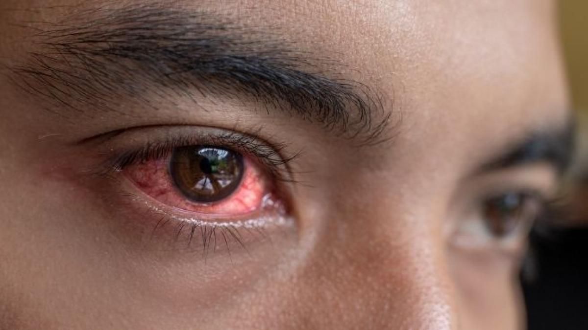Pfizer prorroga programa para eliminar tracoma, que causa ceguera