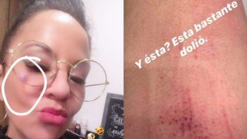 Algunas de las fotos que publicó Miss Bolivia