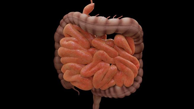 cancer de colon 1200.jpg