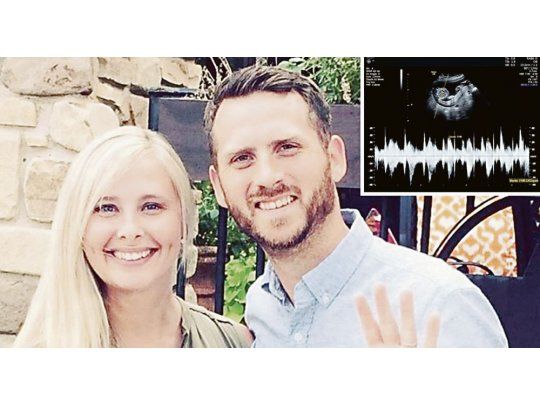 Los padres. Keri y Royce decidieron seguir adelante con el embarazo de su bebé a pesar de que le diagnosticaron anencefalia.