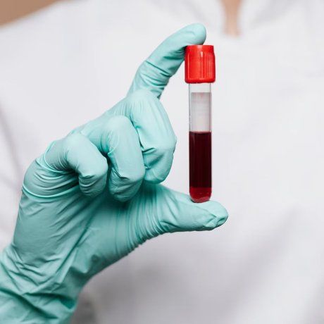 Los investigadores aprovecharon el poder natural de las células T sanas y eliminaron a las perjudiciales. Los investigadores aprovecharon el poder natural de las células T sanas y eliminaron a las perjudiciales.