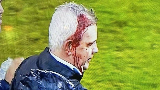 El técnico de México Javier Aguirre sufrió un corte en su cabeza tras impactarle una lata arrojada por un aficionado hondureño.