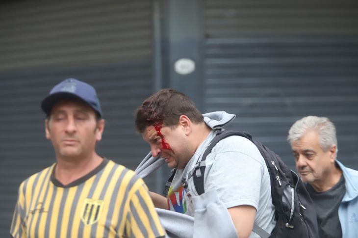 Al menos 25 civiles fueron heridos durante la manifestación del miércoles.