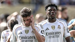 la impactante cicatriz de valverde tras su pelea con tchouameni en el madrid la impactante cicatriz de valverde tras su pelea con tchouameni en el madrid
