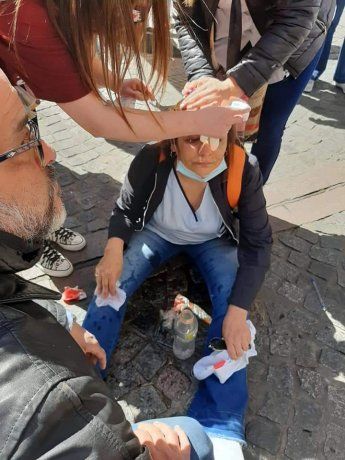 Queríamos entregar un petitorio a los legisladores y los policías nos agredieron, sostuvo Cáceres.