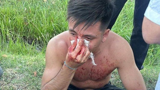 Mateo di Bari sufrió graves lesiones tras un ataque de rugbiers.