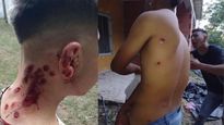 investigan a 25 policias por dispararles a 11 jovenes tras una fiesta