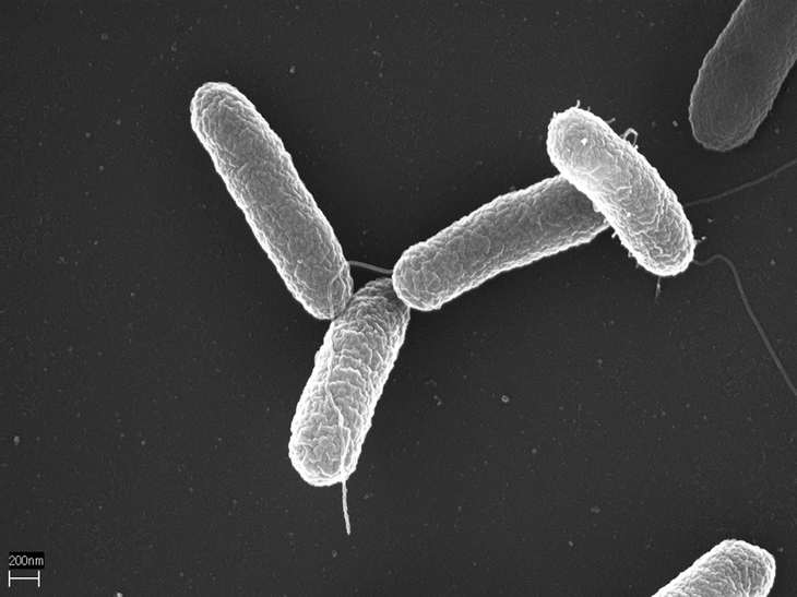 La enfermedad es causada por la bacteria del género Salmonella Typhi (S. Typhi) La enfermedad es causada por la bacteria del género Salmonella Typhi (S. Typhi)