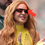 La cicatriz de Shakira. La cicatriz de Shakira.