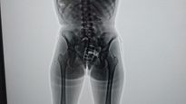 El body scan arrojó imágenes comprometedoras.
