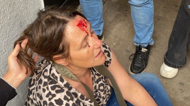 Una fuerte pelea entre dos alumnos dejó herida a una preceptora.