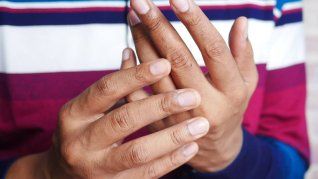 La simplicidad del procedimiento y el no requerir de equipamientos favorece su adopción en distintos contextos. La simplicidad del procedimiento y el no requerir de equipamientos favorece su adopción en distintos contextos.