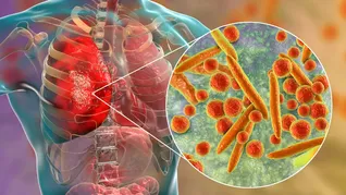 De los más de 8.000 pacientes participantes, más de 4.300 recibieron el nuevo protocolo. De los más de 8.000 pacientes participantes, más de 4.300 recibieron el nuevo protocolo.