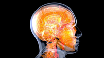 Cómo afectan al cerebro determinados hábitos.