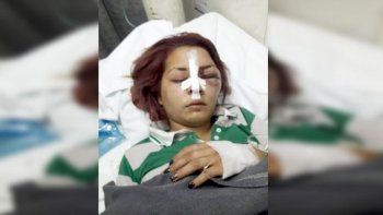 Priscila Barreto luego del ataque