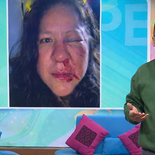 Integrante de Venga la Alegría sufre feroz golpiza. Integrante de Venga la Alegría sufre feroz golpiza.