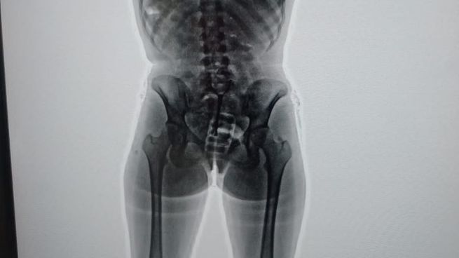 El body scan arrojó imágenes comprometedoras.