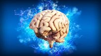 Cerebro.