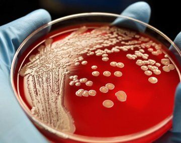 La peligrosa bacteria que actúa en silencio La peligrosa bacteria que actúa en silencio