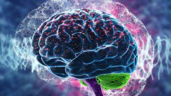 Cerebro.