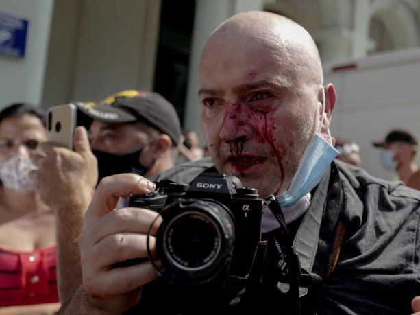 Un fotógrafo de la agencia AP fue agredido por militantes del régimen cubano.