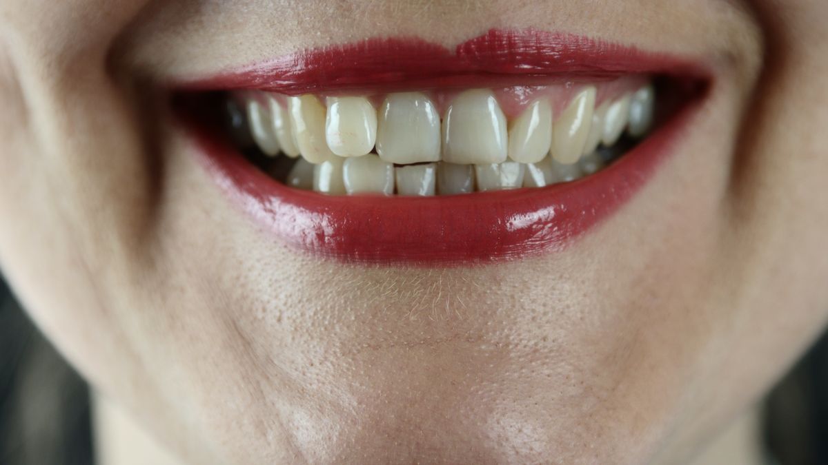 The reason why teeth get yellow, according to specialists
