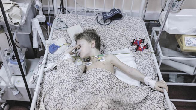 HORROR. Un niño de la ciudad portuaria de Mariúpol está internado luego de sufrir lesiones por un ataque ruso.