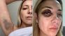 Las fotos de la violencia recibida por Fabiola Yañez.&nbsp;