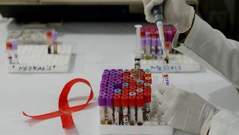Cada 1 de diciembre se celebra el Día Mundial de la Lucha contra el SIDA (Síndrome de Inmunodeficiencia Adquirida), una complicación de la enfermedad conocida como VIH (Virus de la Inmunodeficiencia Humana).