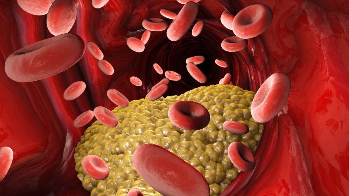 Triglycerides, what they are, and why it is so dangerous to have a high level of them