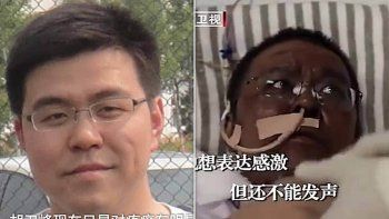 El caso de&nbsp;Hu Weifeng cobr&oacute; notoriedad en China porque su piel se oscureci&oacute;.