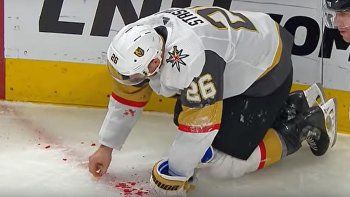 Paul Stastny busca sus dientes en el hielo sangrado.