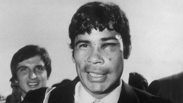 Combín, jugador argentino del Milán, terminó con el rostro herido e incluso fue detenido.