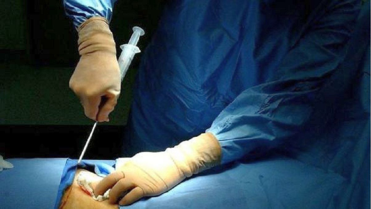 5 Facts to Know About Bone Marrow Transplantation