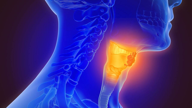 El dolor de garganta es uno de los síntomas más comunes en este tipo de enfermedades virales.