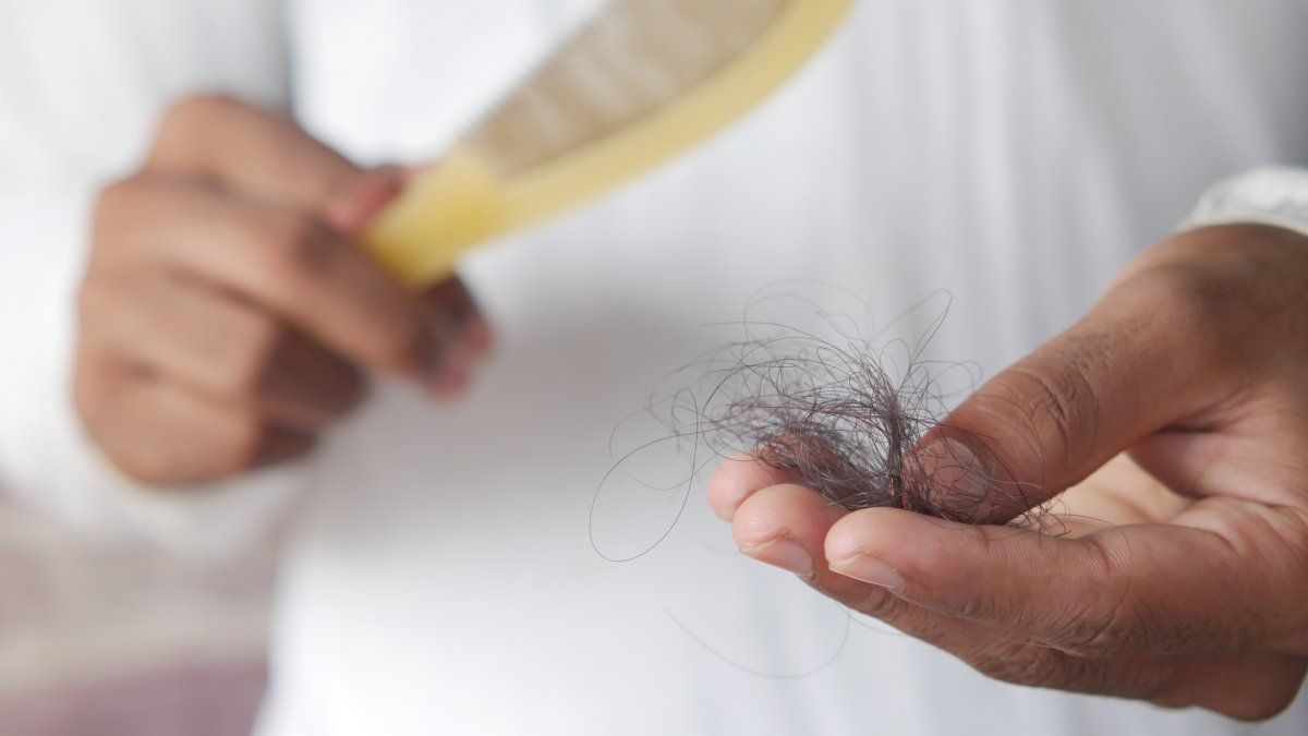 How to prevent hair loss?