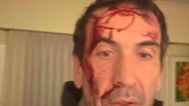 Cervi compartió esta foto tras el ataque en Neuquén.